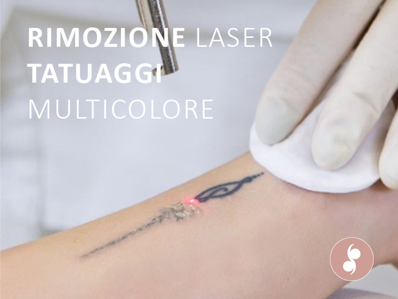 rimozione laser tatuaggi medicalspa brescia